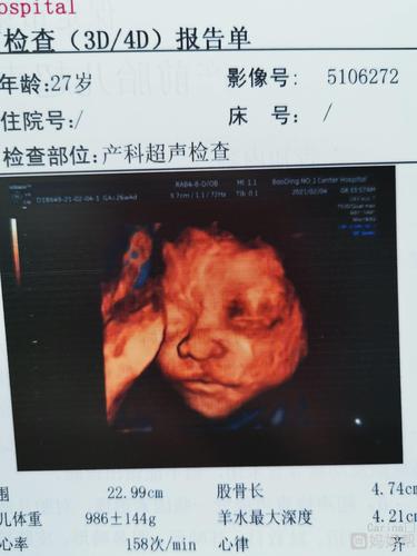 怎么看着有点儿唇裂呢?但是医生说没事,b