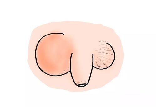 呵护男宝私处健康,别马虎