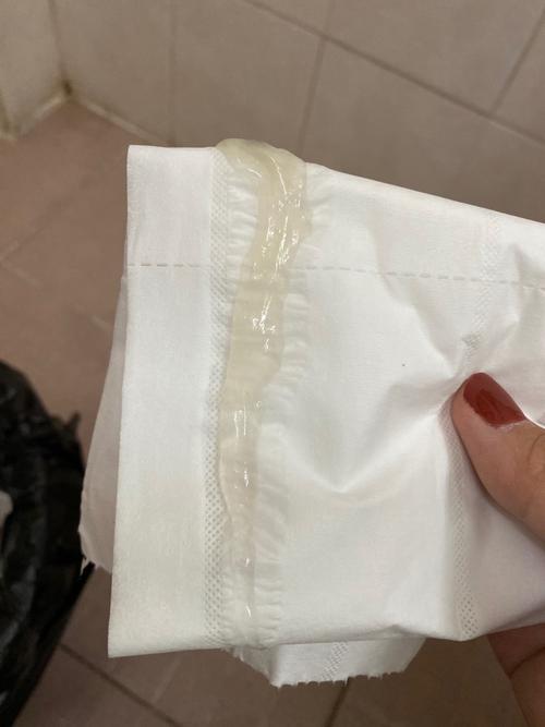 白带像白色透明鼻涕,这是在排卵期吗?