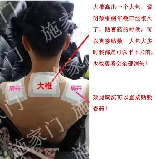 施家门膏药贴敷颈椎病效果再好,都不如提前预防好!