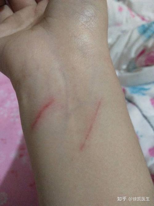 伤口较大,出血不止