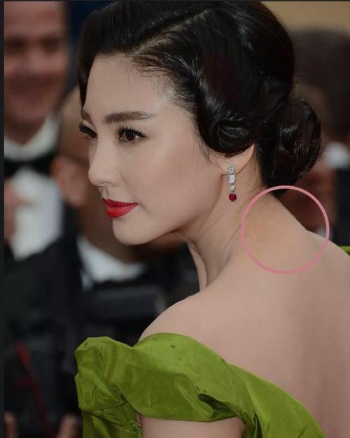 张雨绮的驼背让自己后背的脊椎变弯,看上去显得肉非常多,十分胖,毫无