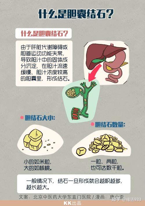 出现明显的症状,多以右上腹绞痛为主, 胆结石患者应坚持定期进行检查