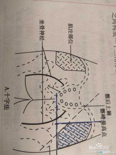 或者有打针定位图啥的?点击查看全文