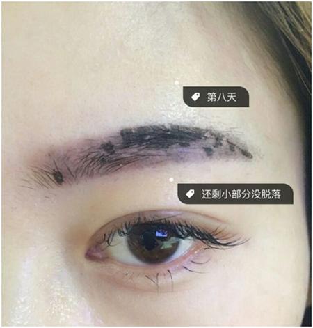 半永久眉毛脱痂整个过程【对号入座】