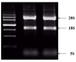 真核生物完整的rna琼脂糖凝胶电泳图