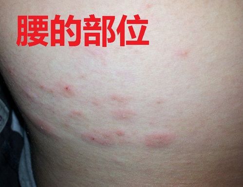 这是什么皮肤病