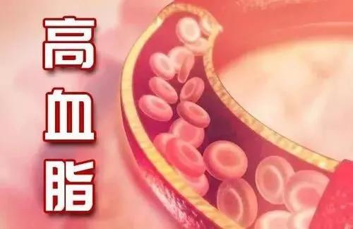 6个症状提示你血脂可能出了问题!对付高血脂,这一招好用!