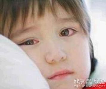 角膜炎的症状有哪些