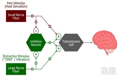 0智能技术accurep64 技术—— 优化的能量输出程序,将调谐脉冲集成