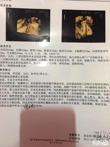 确定男宝一枚,之前发的四维单有猜对的