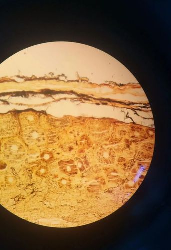 医学生的浪漫 | 显微镜下有我们的"微"美小宇宙