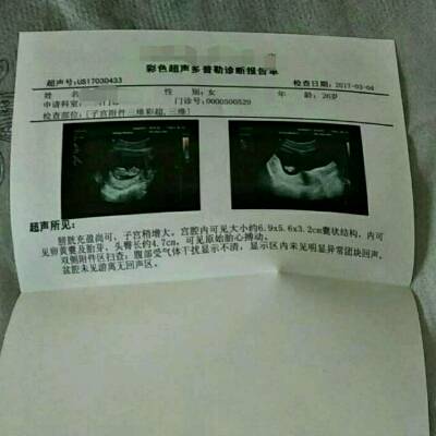 这是11周的彩超,谁能告诉我男宝宝,女宝宝.谢谢