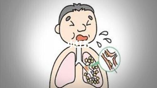 治疗支气管扩张的4个饮食禁忌