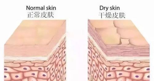 皮肤缺水干燥?容易长皱纹?你的保湿工作做好了吗?