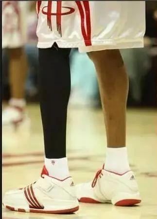 篮球明星麦迪的小腿(图片来自百度图片)