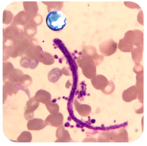 形态学报告中血小板应该如何描述 | 经验分享