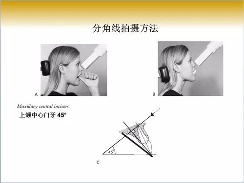 口腔x线片拍摄定位技巧