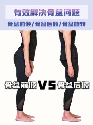 全网最科学解决骨盆前倾/后倾/旋转问题_骨盆_骨盆前倾_设计_故事
