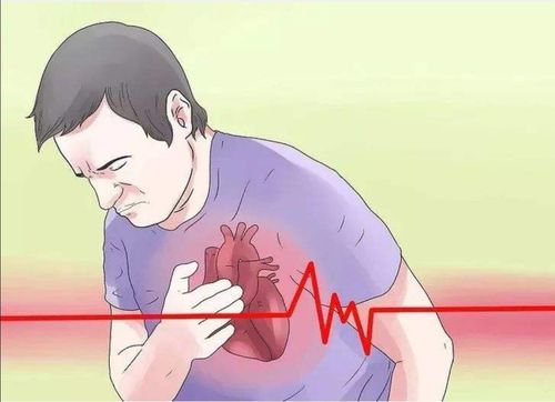 镇安县医院胸痛中心建设(三)