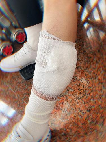 照片中看到他的腿已经用纱布包扎好了,接下来应该是好好养伤.