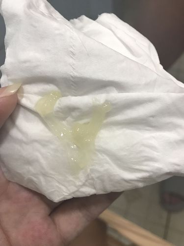 怀孕38周整,刚上厕所流出淡黄色果冻状分泌物.不知道