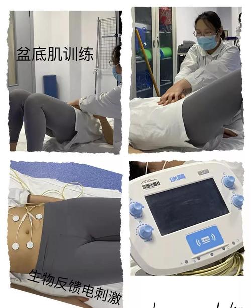 运动疗法,骨盆矫正技术,盆底肌电刺激