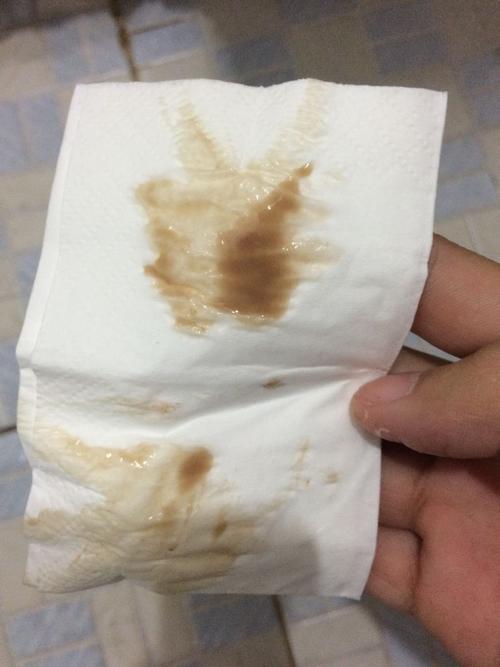43    浏览  33333  满意回答 你好,这是有妇科炎症的可能性,如盆腔炎