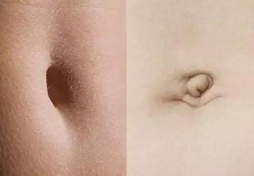 不能抠的肚脐眼究竟藏了什么秘密