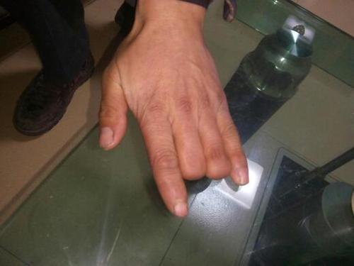 请问手残疾可以考驾照吗?