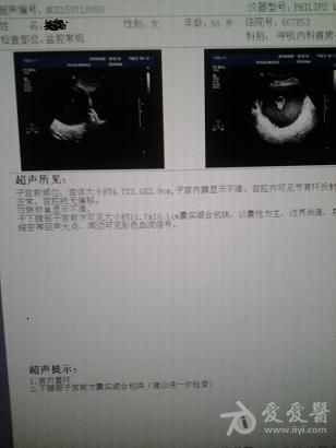 膀胱顶占位性病变?