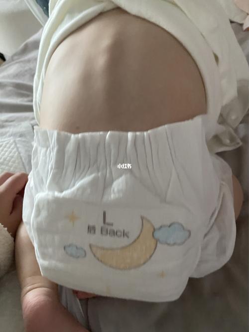 快七个月的宝宝趴着腰脊椎突出来的_生长发育_宝宝