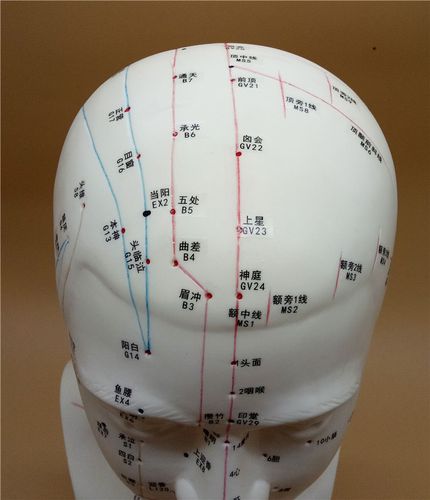 伟叶头部针灸穴位模型大小可选高经络穴位图脑袋面脸部按摩刮痧丰帆铜