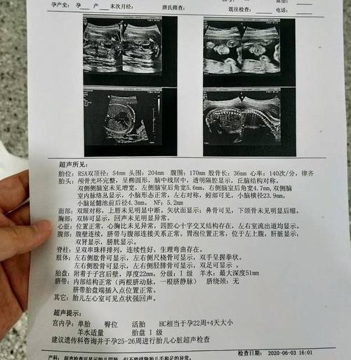 接产检一路绿灯通过!_会看系统单子的帮忙看看是女