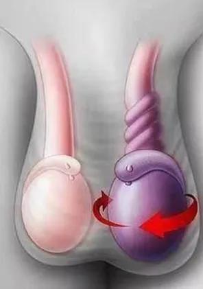 余姚两个男孩因"蛋疼"被父母紧急送医 结果却是有喜有悲!