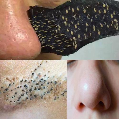 片去黑头神器男女祛黑头粉刺收缩毛孔撕拉式鼻头吸黑头面膜鼻贴 10