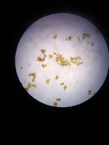 (4)谷子白发病菌的卵孢子.