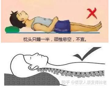 颈椎突出用什么枕头睡觉比较好