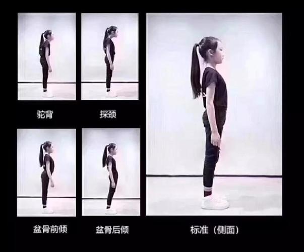 少儿模特怎样改善形体?