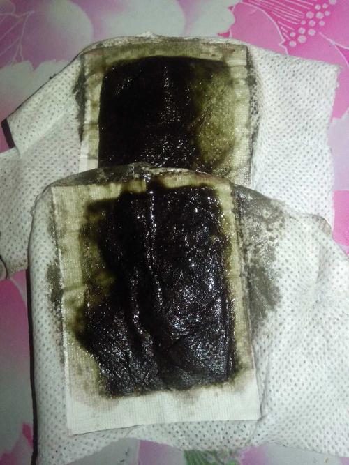 经期贴上这个足贴还真好,排出了这么多油和毒素,是要瘦瘦的节奏么