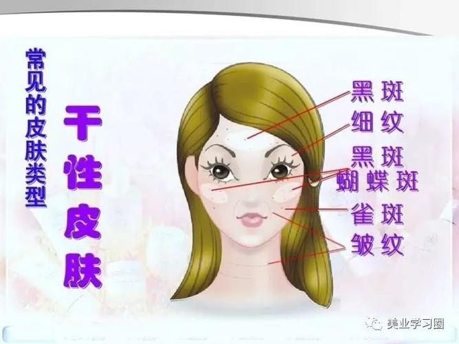 【皮肤知识】皮肤分类及特征