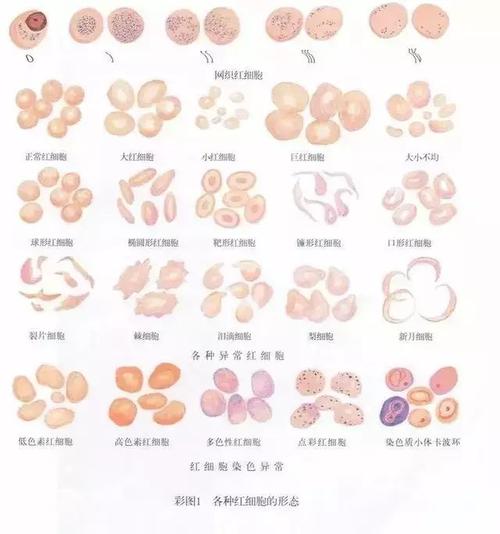 科学告诉你:如何从血液红细胞的形状看身体健康