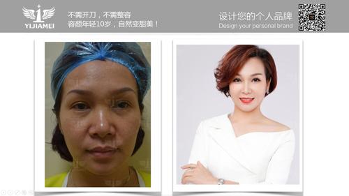 超级巨星李恩丽罗嘉良明星见面会我们相约医佳美不见不散