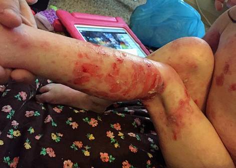 3岁女孩真实的"木乃伊"生活 | 故事