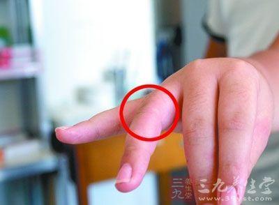 【健康】有没有癌一根手指告诉你