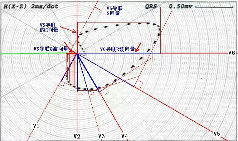 心电向量基础知识