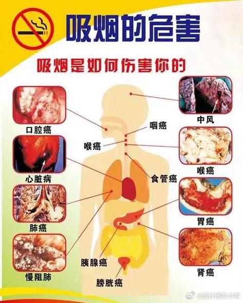 身体#即便不过肺,香烟燃烧产生的尼古丁,焦油等有害物质,仍会通过口腔