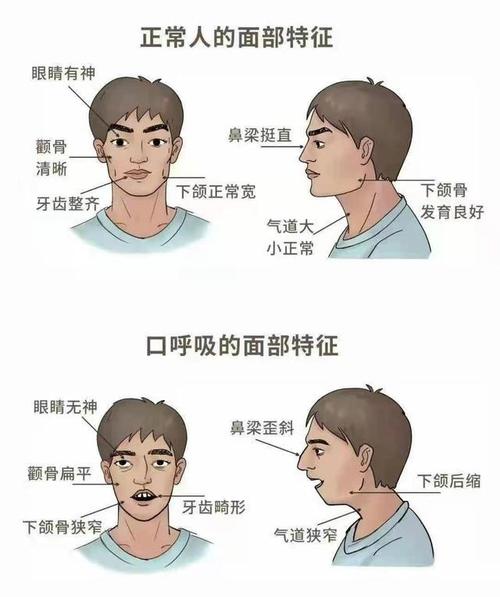 不走弯路不焦虑科学解读口呼吸