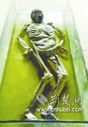 新闻频道 历史探秘新闻 > 正文专题:图片频道     荆门市干警透露了"