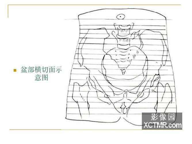 人体断层解剖图谱(盆腔)